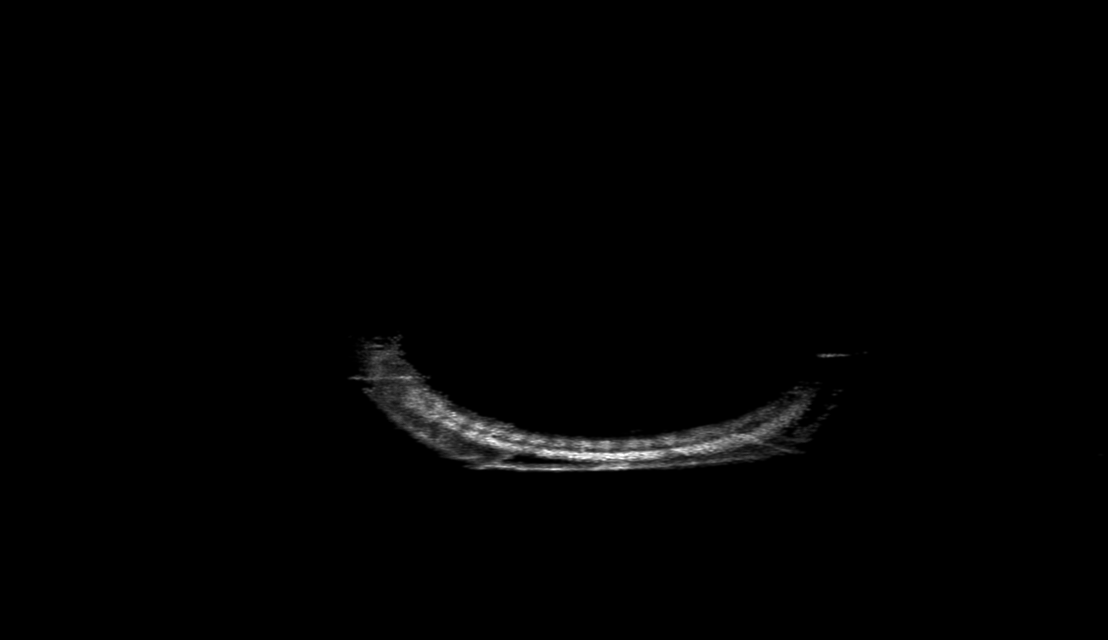 NAS-GS with denoising rendered sonar image of offshore anode
